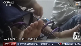 术后麻烦不断 禁而不止的“断骨增高”有多坑？