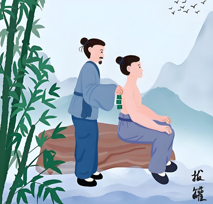 拔罐并非“万能术”,这些误区应知晓 拔罐并非“万能术”,这些误区应知晓