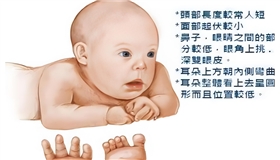 世界唐氏综合征日：重视产前筛查 孕育健康宝宝
