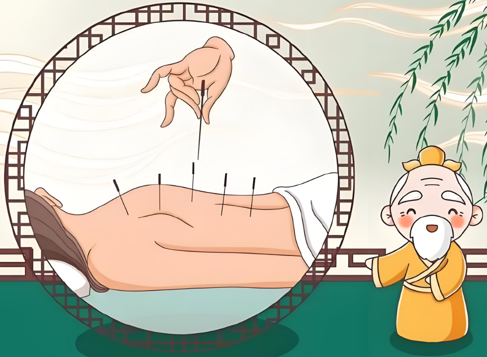 穴位埋线减肥法真能减重吗？它适合所有人吗？