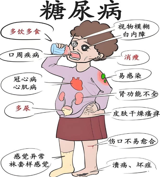 全国糖尿病“三师共管”示范中心成立 全国糖尿病“三师共管”示范中心成立