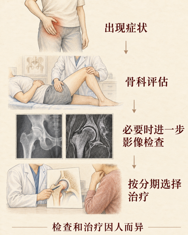 股骨头坏死究竟“坏”在哪? 专家提醒:这四类高危人群要警惕 第 3 张 股骨头坏死究竟“坏”在哪? 专家提醒:这四类高危人群要警惕 第 3 张